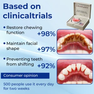 Nurbini™ Advanced Customized Full Denture