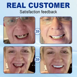 Nurbini™ Advanced Customized Full Denture