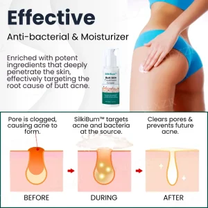 SilkiBum Butt Skin Treatment Cream 350882 6