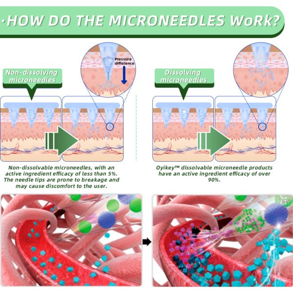Oyikey SMGT-GLP-1 Nano Microneedle Patch (Painless, long-lasting, addressing diabetes, obesity, and cardiovascular diseases)