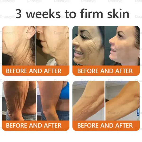 Daasry® "Dermal Gold" Botox Bee Venom Skin Restoration Cream