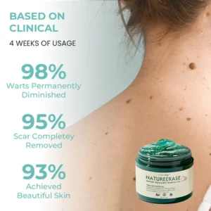 Oveallgo® NatureErase Plus Instant Mole & Spot Removal Gel 20 Oveallgo® NatureErase Plus Instant Mole & Spot Removal Gel