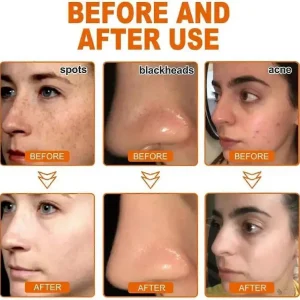 Seurico™ Whitening and Freckle - Removing Mask