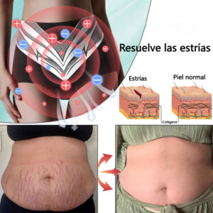 Anyidea™ Self-Regulating Tourmaline Shapewear Shorts