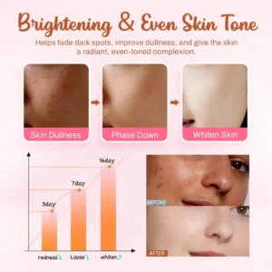 Slimoly™ Whitening and Freckle – Removing Mask